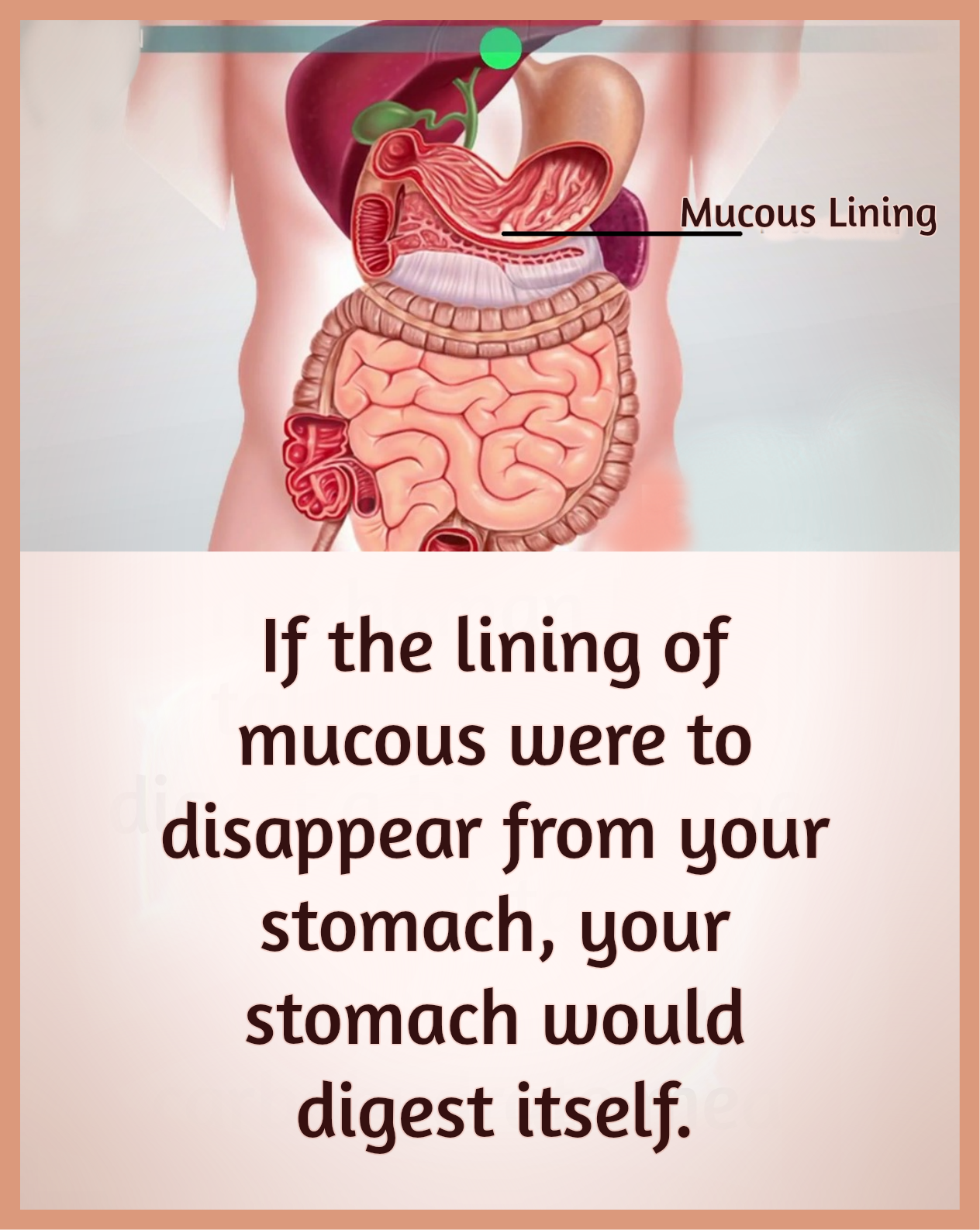If the lining of mucus were to disappear from your stomach ...
