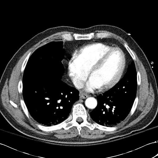 22 year old with abdominal pain following fall from a horse. : Radiology