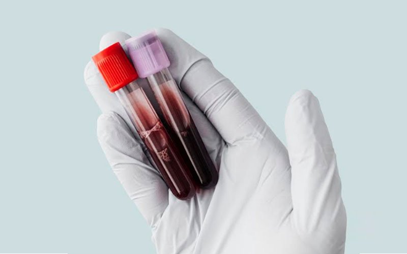 Blood test detects cancer years before standard diagnosis