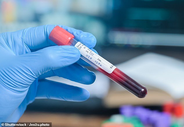 Blood tests to detect pancreatic cancer may be available within a few ...