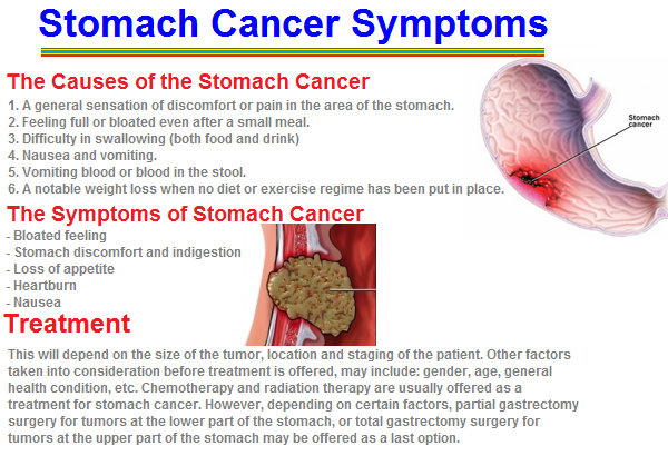 Cancer Detail Care: Stomach Cancer Symptoms