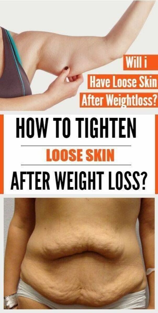 How to Tighten Loose Skin and Sagging Skin