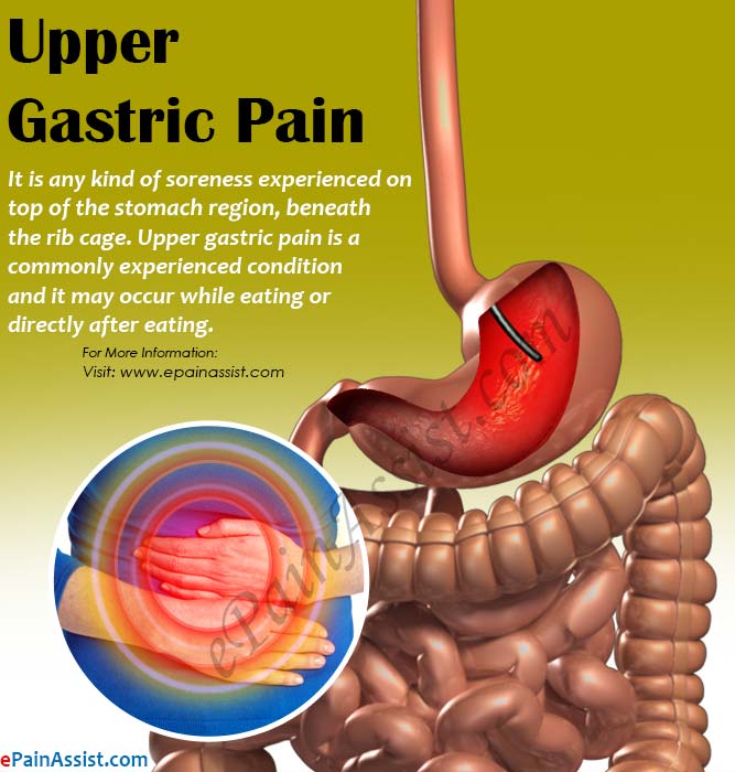 Upper Gastric Pain: 11 Causes of Pain on Top of the Stomach