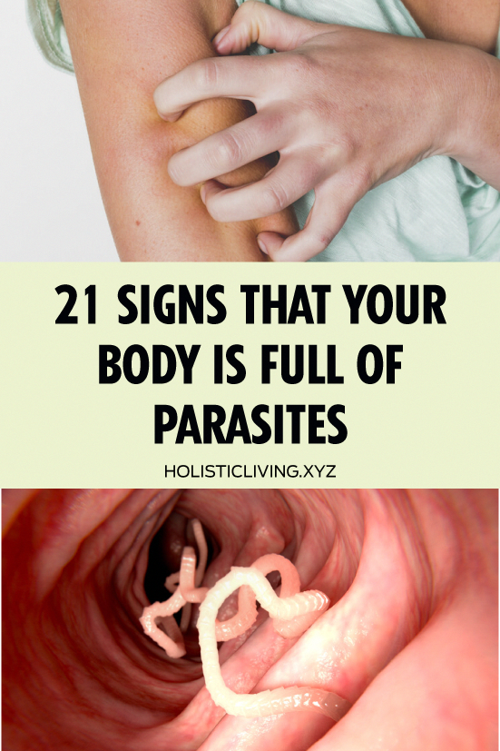 21 Signs That Your Body is Full of Parasites #healthyliving ...