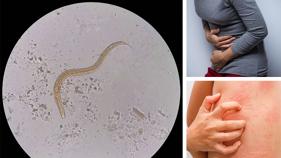 7 Strange Signs You Have A Parasite Living Inside Of You Right Now