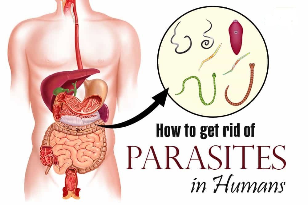 How to get ride of parasites in human: Causes, Symptoms and Cure of ...