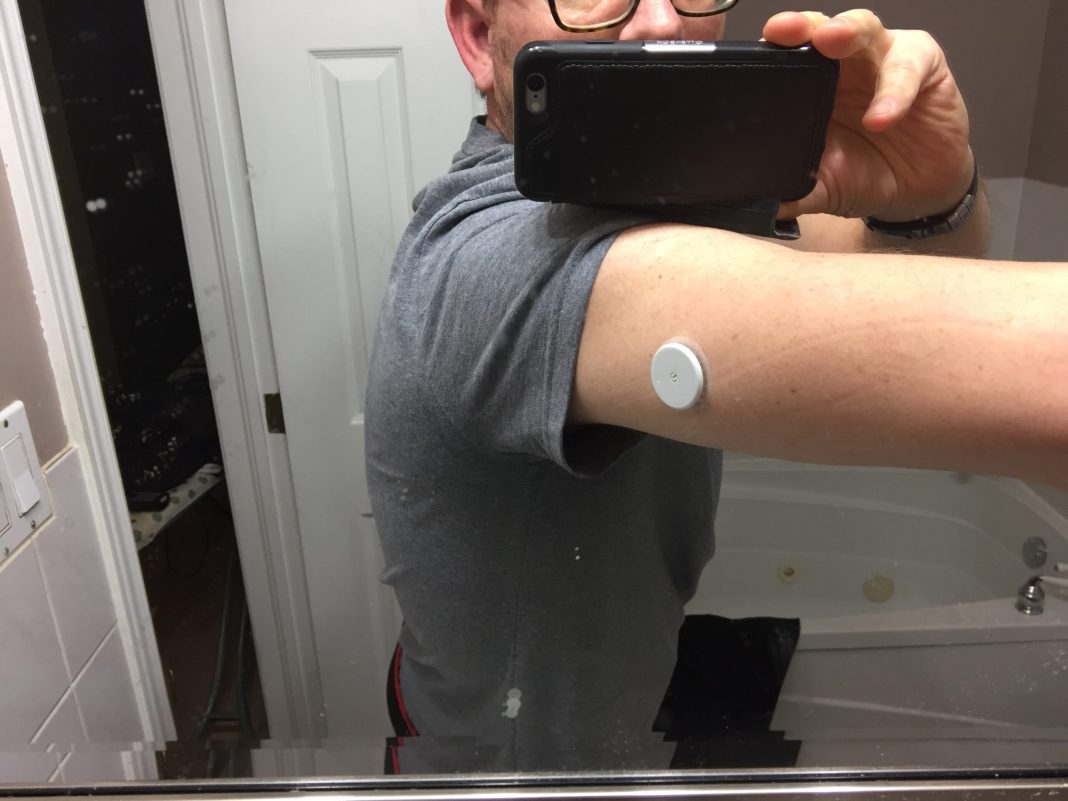 Benefits of a CGM (Freestyle or Dexcom G6) for Diabetes Control