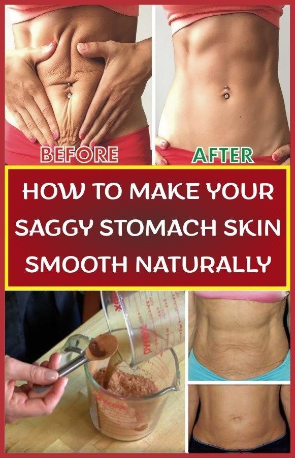 How To Make Your Saggy Stomach Skin Smooth Naturally