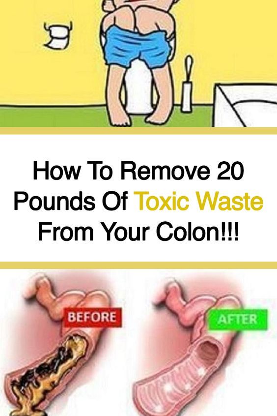 How To Remove 20 Pounds Of Toxic Waste From Your Colon!!!