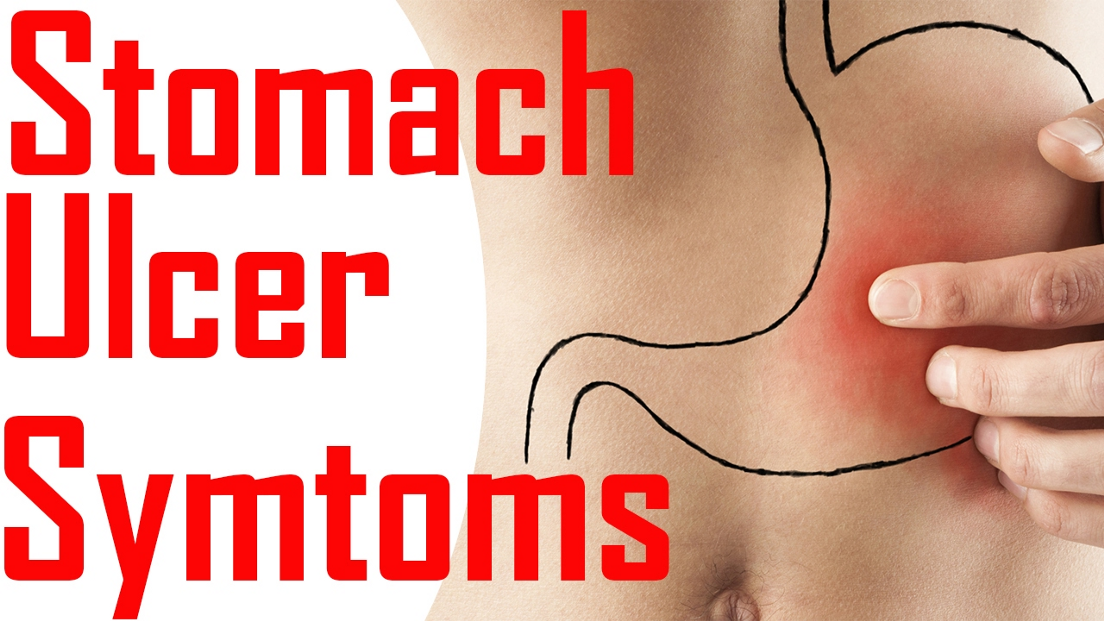 Lets understand Stomach Ulcers.. There is no clear evidence to suggest ...