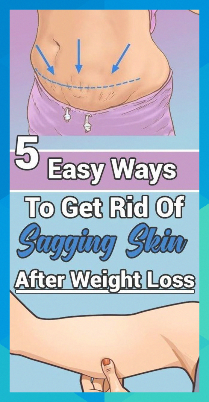 Pin on How To Fix Saggy Skin On Stomach