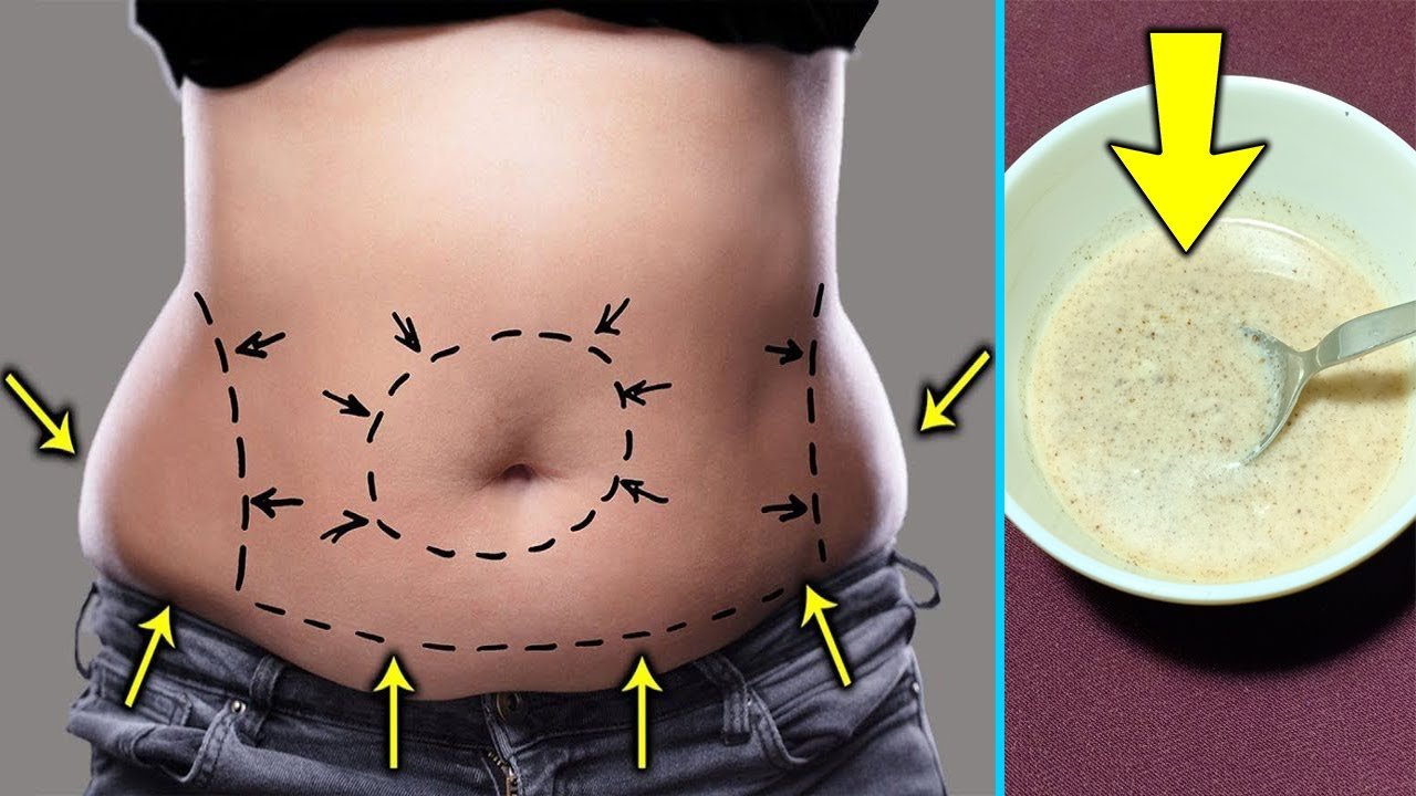 Reduce Belly Fat Lose 15 Kg In 10 Days, No Diet, No Exercise, Only ...