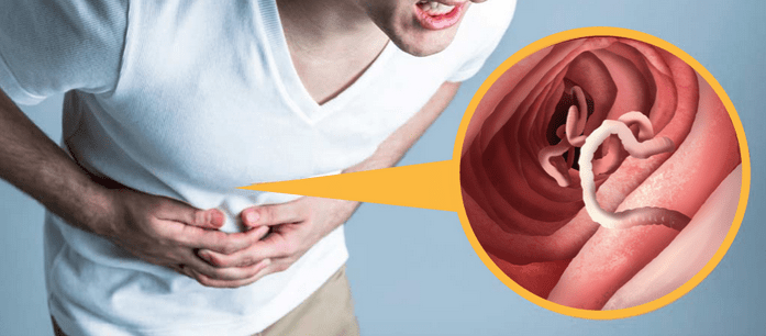 Stomach Parasite Removal Review