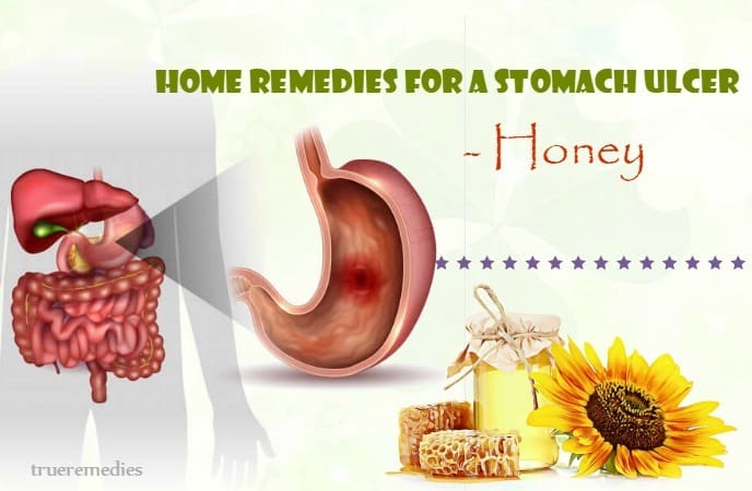 16 Safe Home Remedies For A Stomach Ulcer Pain Relief