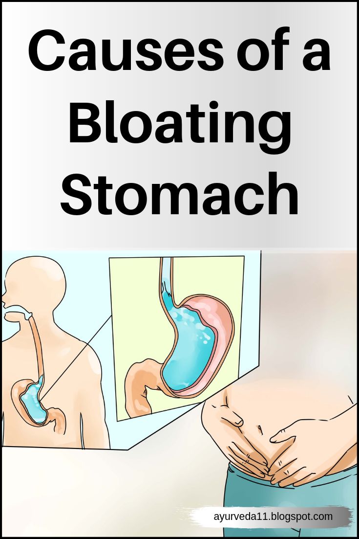 Causes of a Bloating Stomach