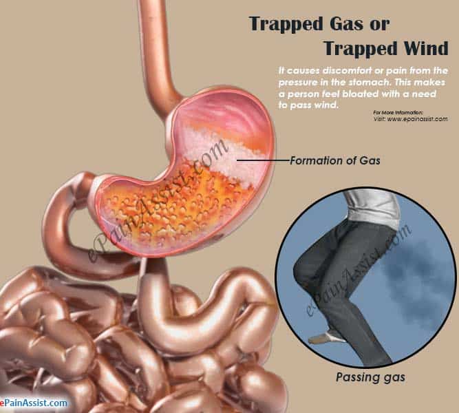 Common Problem â Trapped Gas â Fit Nepal