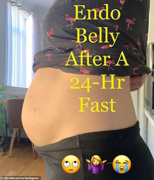 Endometriosis sufferers share photos of their severely bloated stomachs ...