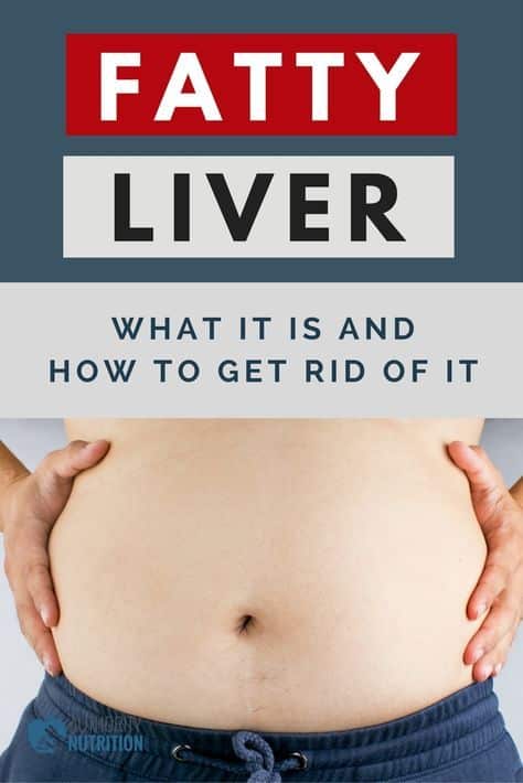 Fatty liver disease affects about 25% of people globally. Here is a ...
