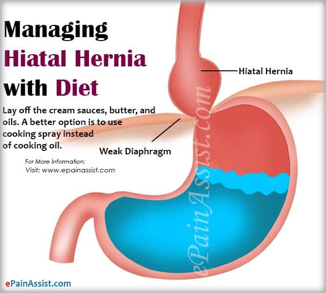 Foods To Avoid With Hiatal Hernia