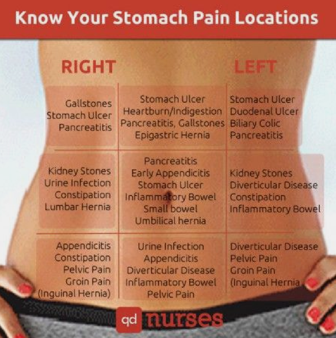 Know your stomach pain locations. : coolguides