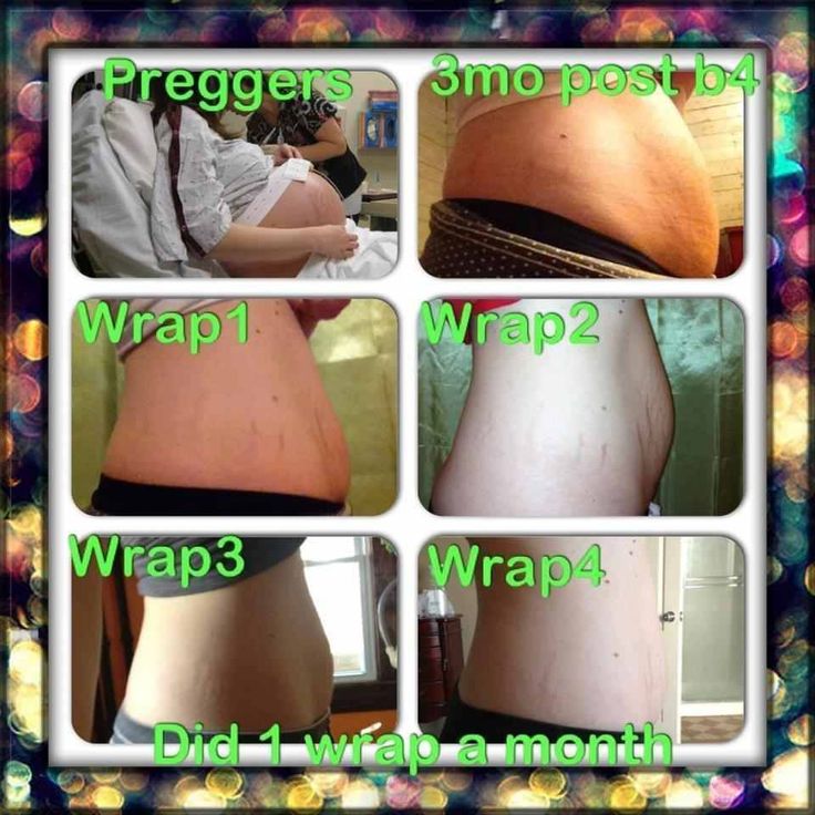 Need to tighten up that belly after baby? You can with a Skinny Wrap ...