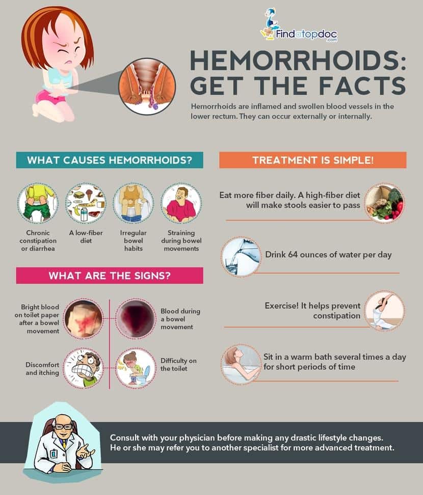Treatments for Hemorrhoids