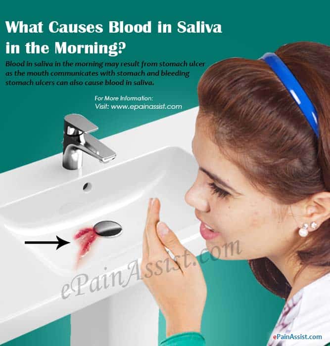 What Causes Blood in Saliva in the Morning?