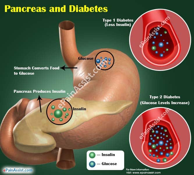 Pancreas and Diabetes: Why does Pancreas Stop Producing Insulin?