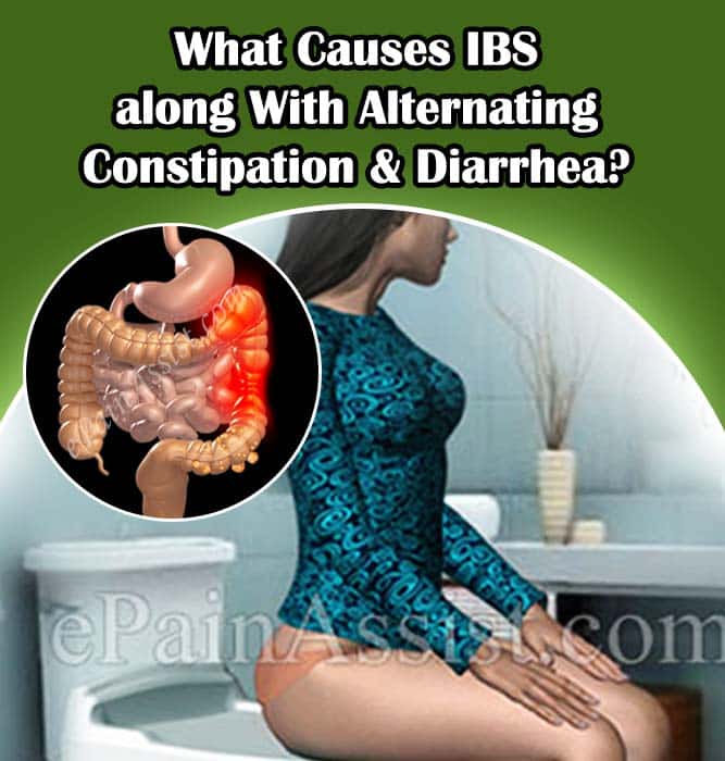 What Causes IBS along With Alternating Constipation &  Diarrhea?