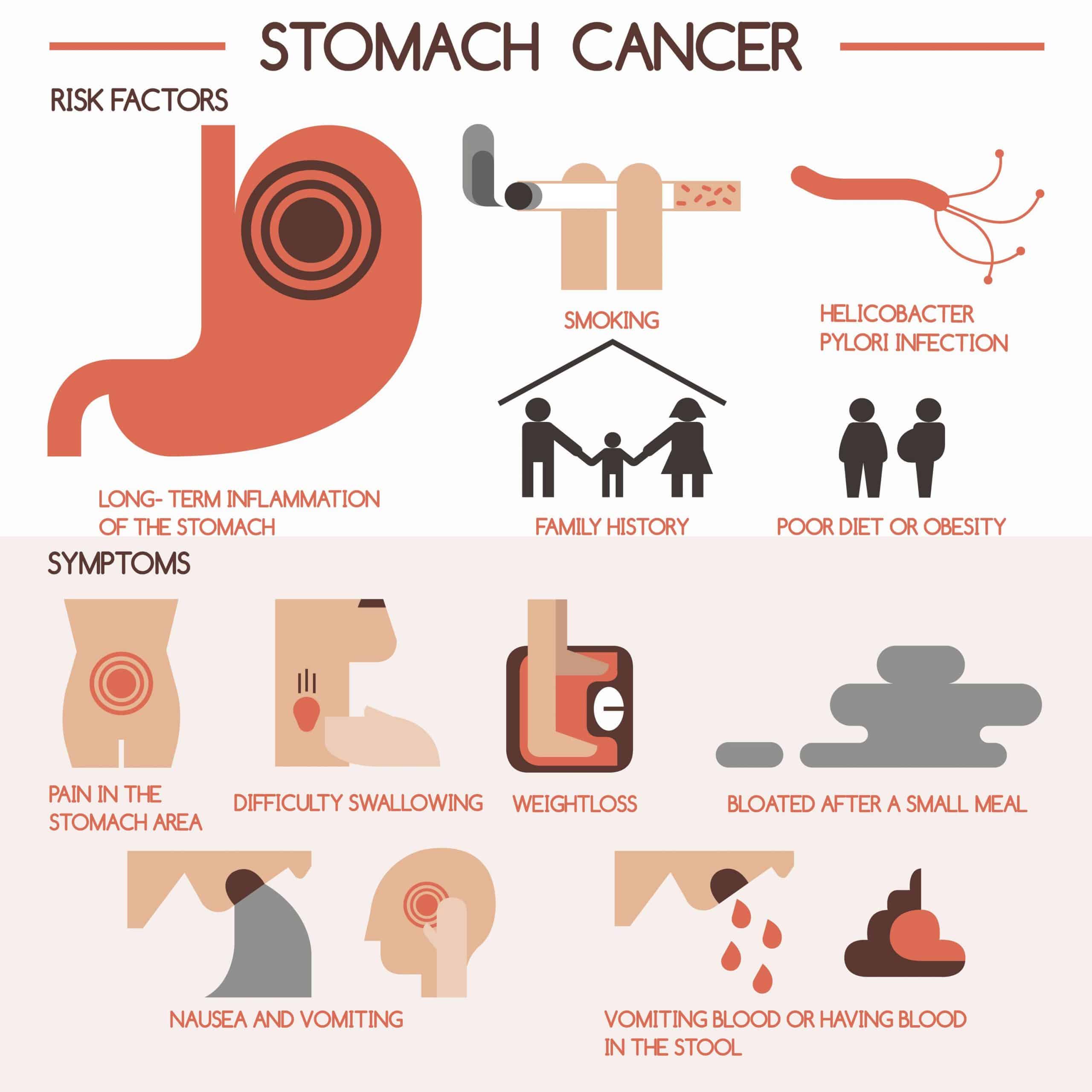Факторы рака желудка